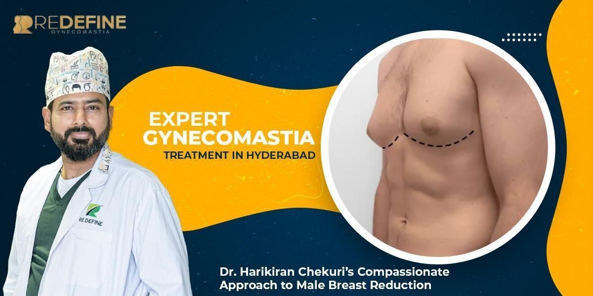Expert Gynecomastia Treatment in Hyderabad: Dr. Harikiran Chekuri’s Compassionate Approach to Male Breast Reduction